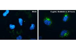ICC/IF Image CYR61 antibody [N1C3] detects CYR61 protein at endoplasmic reticulum by immunofluorescent analysis. (CYR61 抗体  (Center))