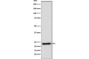 Western blot analysis of RAIDD expression in HeLa cell lysate.