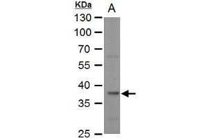 WB Image LDH-B antibody detects LDH-B protein by western blot analysis. (LDHB 抗体)