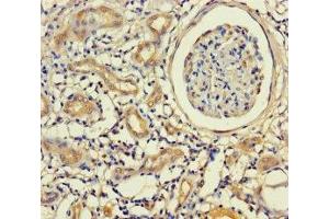 Immunohistochemistry of paraffin-embedded human kidney tissue using ABIN7157448 at dilution of 1:100 (Keratin 71 抗体  (AA 201-500))