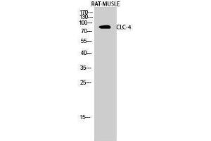 Western Blotting (WB) image for anti-Chloride Channel 4 (CLCN4) (Internal Region) antibody (ABIN3174434) (CLCN4 抗体  (Internal Region))
