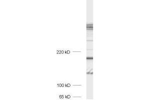dilution: 1 : 1000, sample: crude synaptosomal fraction of rat brain (P2) (Bassoon 抗体)
