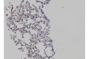 ABIN6266165 and ABIN6277198 at 1/100 staining Mouse lung tissue by IHC-P.