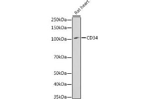 Western blot analysis of extracts of Rat heart, using CD34 antibody (ABIN3021123, ABIN3021124, ABIN3021125, ABIN1512704 and ABIN6213981) at 1:1000 dilution. (CD34 抗体  (AA 32-290))