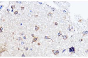 Immunohistochemistry of paraffin-embedded Rat brain using ATXN2 Polyclonal Antibody at dilution of 1:100 (40x lens). (Ataxin 2 抗体)