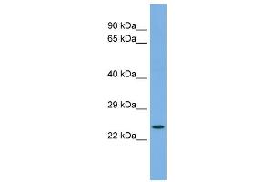 Host:  Rabbit  Target Name:  FAP  Sample Type:  COLO205 Whole cell lysates  Antibody Dilution:  1. (FAP 抗体  (C-Term))