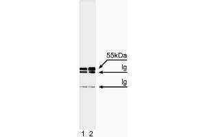 Immunoprecipitation/western blot analysis of caspase-8. (Caspase 8 抗体  (full length))
