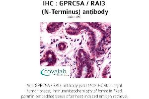 Image no. 1 for anti-G Protein-Coupled Receptor, Family C, Group 5, Member A (GPRC5A) (Extracellular Domain), (N-Term) antibody (ABIN1735210)