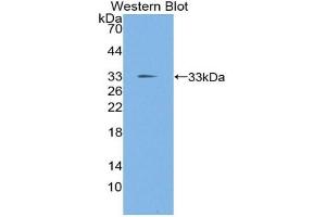 Detection of Recombinant TIEG1, Mouse using Polyclonal Antibody to TGF Beta Inducible Early Response Gene 1 (TIEG1) (KLF10/TIEG1 抗体  (AA 206-473))