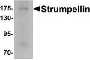 Western blot analysis of Strumpellin in human ovary tissue lysate with Strumpellin Antibody  at 1 μg/ml. (Strumpellin 抗体  (C-Term))