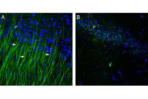 Expression of TRPM6 in rat hippocampus. (TRPM6 抗体  (1st Extracellular Loop))