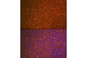 Immunofluorescence analysis of mouse liver using Alpha-2-Macroglobulin (Alpha-2-Macroglobulin (M)) Rabbit mAb (ABIN7265558) at dilution of 1:100 (40x lens). (alpha 2 Macroglobulin 抗体)