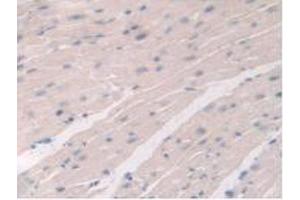 IHC-P analysis of Mouse Heart Tissue, with DAB staining. (DDX58 抗体  (AA 1-211))