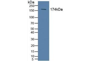 Detection of ABCC2 in Human Serum using Polyclonal Antibody to ATP Binding Cassette Transporter C2 (ABCC2) (ABCC2 抗体  (AA 1300-1534))