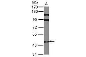 Image no. 1 for anti-Zinc Finger Protein 384 (ZNF384) (N-Term) antibody (ABIN1494117) (ZNF384 抗体  (N-Term))