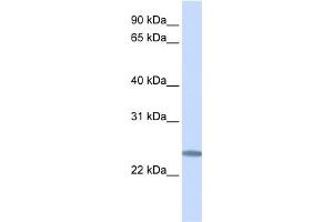 WB Suggested Anti-C12orf49 Antibody Titration:  0.