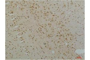 Immunohistochemistry (IHC) analysis of paraffin-embedded Rat Brain Tissue using Cav1. (CACNA1C 抗体)