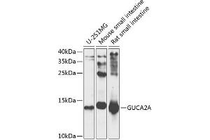 Western blot analysis of extracts of various cell lines, using GUCA antibody (ABIN6127993, ABIN6141529, ABIN6141530 and ABIN6225126) at 1:1000 dilution. (GUCA2A 抗体  (AA 22-115))