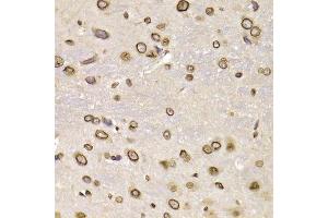 Immunohistochemistry of paraffin-embedded rat brain using LMNB2 Antibody.