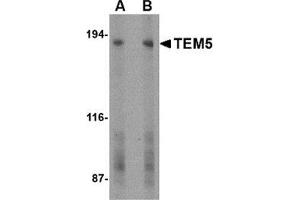 Western blot analysis of TEM5 in human bladder tissue lysate with this product at (A) 2 and (B) 4 μg/ml.