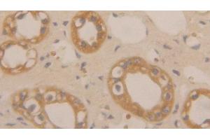 Detection of CLC in Human Kidney Tissue using Polyclonal Antibody to Charcot Leyden Crystal Protein (CLC) (Galectin 10 抗体  (AA 2-142))
