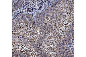IHC analysis of CD147/Emmprin using anti-CD147/Emmprin antibody (ABIN7599999).