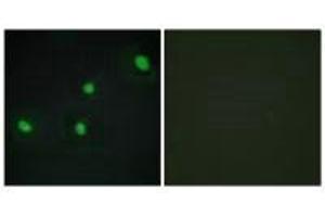 Immunofluorescence analysis of HepG2 cells, using CDCA4 antibody. (CDCA4 抗体)