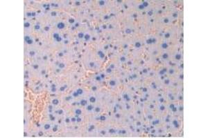 IHC-P analysis of Mouse Liver Tissue, with DAB staining. (CD47 抗体  (AA 18-219))
