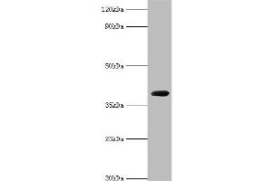 Western blot analysis of recombinant Carboxypeptidase G2 (0. (Carboxypeptidase G2 抗体  (AA 23-415))
