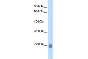 Western Blotting (WB) image for anti-Regulator of G-Protein Signaling 1 (RGS1) antibody (ABIN2462642) (RGS1 抗体)
