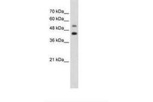 Image no. 1 for anti-GTP Binding Protein 2 (GTPBP2) (AA 511-560) antibody (ABIN203420) (GTPBP2 抗体  (AA 511-560))