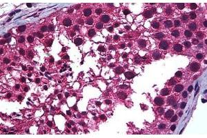 Human Testis: Formalin-Fixed, Paraffin-Embedded (FFPE) (Retinoic Acid Receptor alpha 抗体  (AA 1-463))