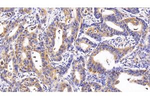 Immunohistochemistry (IHC) image for anti-Colony Stimulating Factor 2 Receptor, Beta (CSF2RB) (AA 133-233) antibody (ABIN7438586)