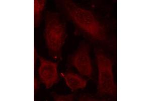 Immunofluorescence staining of methanol-fixed Hela cells using Phospho-DOK2-Y299 antibody. (DOK2 抗体  (pTyr299))