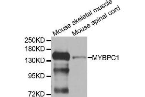 Western blot analysis of extracts of mouse skeletal muscle and mouse spinal cord cell lines, using MYBPC1 antibody. (MYBPC1 抗体)