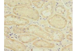 Immunohistochemistry (IHC) image for anti-Solute Carrier Family 22 (Organic Anion Transporter), Member 8 (SLC22A8) (AA 473-542) antibody (ABIN7170165)