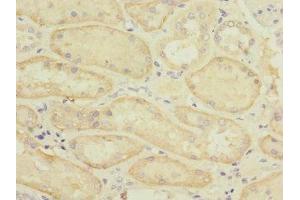 Immunohistochemistry of paraffin-embedded human kidney tissue using ABIN7170165 at dilution of 1:100 (SLC22A8 抗体  (AA 473-542))