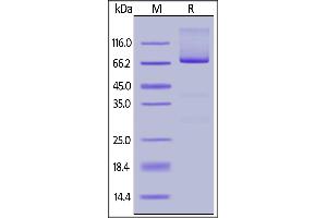 SDS-PAGE (SDS) image for Glypican 3 (GPC3) (AA 25-559) (Active) protein (His tag,FITC) (ABIN6731253)