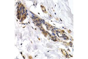 Immunohistochemistry of paraffin-embedded human normal breast using PKLR antibody (ABIN5970989) at dilution of 1/200 (40x lens). (PKLR 抗体)