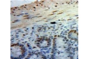 Used in DAB staining on fromalin fixed paraffin-embedded Bowels tissue (HMGA1 抗体  (AA 3-107))