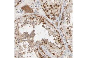 Immunohistochemical staining (Formalin-fixed paraffin-embedded sections) of human testis with MAGEA8 polyclonal antibody  shows strong nuclear and cytoplasmic positivity in cells in seminiferous ducts and strong cytoplasmic positivity in Leydig cells at 1:50-1:200 dilution. (MAGEA8 抗体)