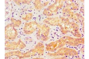 Immunohistochemistry of paraffin-embedded human kidney tissue using ABIN7143174 at dilution of 1:100 (ACVR1 抗体  (AA 20-125))