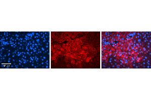 Rabbit Anti-IRF1 Antibody   Formalin Fixed Paraffin Embedded Tissue: Human Liver Tissue Observed Staining: Cytoplasm in hepatocytes Primary Antibody Concentration: 1:100 Other Working Concentrations: 1:600 Secondary Antibody: Donkey anti-Rabbit-Cy3 Secondary Antibody Concentration: 1:200 Magnification: 20X Exposure Time: 0. (IRF1 抗体  (N-Term))