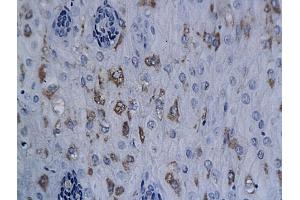 Immunohistochemistry (IHC) image for anti-X-Ray Repair Complementing Defective Repair in Chinese Hamster Cells 1 (XRCC1) (AA 1-120) antibody (ABIN673539)