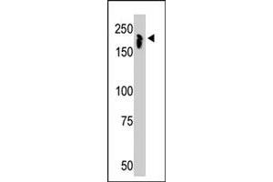 The NCOR1 polyclonal antibody  is used in Western blot to detect NCOR1 in mouse thymus tissue lysate.