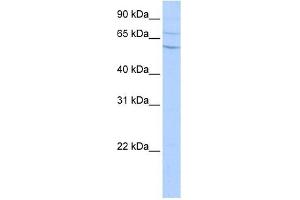 Carboxypeptidase N2 antibody used at 0. (CPN2 抗体  (N-Term))