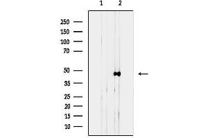anti-Actin, gamma 2, Smooth Muscle, Enteric (ACTG2) (N-Term) antibody