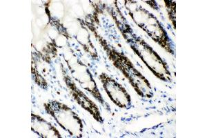 Anti- MCM7 Picoband antibody,IHC(P) IHC(P): Rat Intestine Tissue (MCM7 抗体  (AA 526-719))