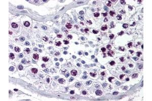 Immunohistochemistry (IHC) image for anti-Cyclin A2 (CCNA2) antibody (ABIN97945)