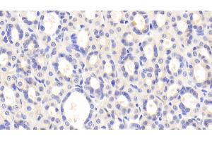 Detection of PZP in Rat Stomach Tissue using Polyclonal Antibody to Pregnancy Zone Protein (PZP) (PZP 抗体  (AA 1251-1500))
